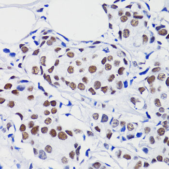 Immunohistochemistry - Acetyl-Histone H2B-K15 pAb 