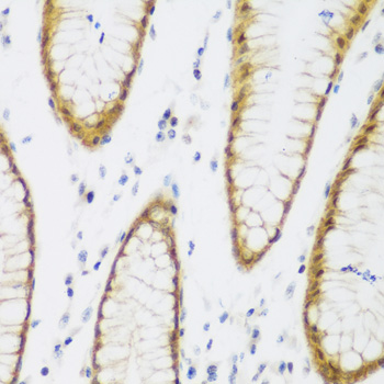 Immunohistochemistry - BRD9 Polyclonal Antibody 