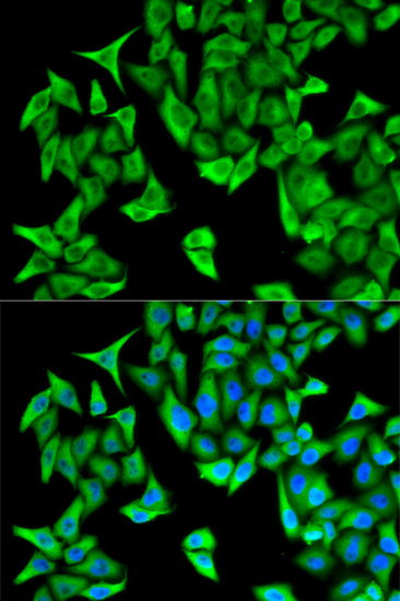 Immunofluorescence - PSMD9 Polyclonal Antibody 