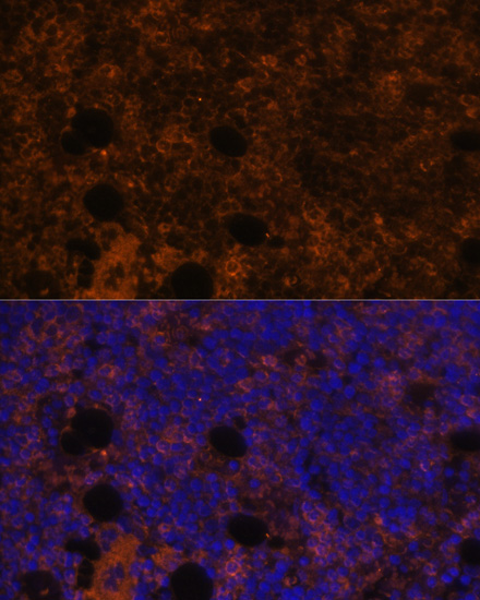 Immunofluorescence - CD11B Polyclonal Antibody 