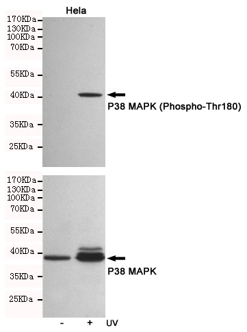 Western blot analysis of extracts from Hela cells, untreated or treated with UV, using P38 MAPK (Phospho-Thr180) Rabbit pAb (166691,1:500 diluted,upper) or p38 MAPK Rabbit pAb (310008,1:500 diluted,lower).