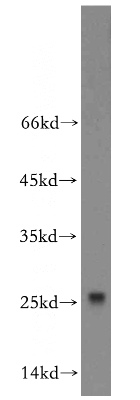 mouse testis tissue were subjected to SDS PAGE followed by western blot with Catalog No:114786(ROPN1L antibody) at dilution of 1:300