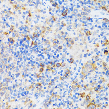 Immunohistochemistry - CHAF1B Polyclonal Antibody 