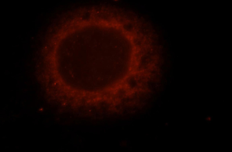 Immunofluorescent analysis of MCF-7 cells, using TNPO2 antibody Catalog No:116157 at 1:25 dilution and Rhodamine-labeled goat anti-rabbit IgG (red).