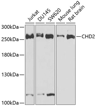 Western blot - CHD2 Polyclonal Antibody 