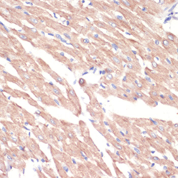 Immunohistochemistry - ADRA1A Polyclonal Antibody 