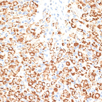Immunohistochemistry - KLHL9 Polyclonal Antibody 