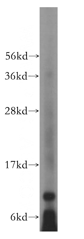 mouse pancreas tissue were subjected to SDS PAGE followed by western blot with Catalog No:113683(PCBD1 antibody) at dilution of 1:100