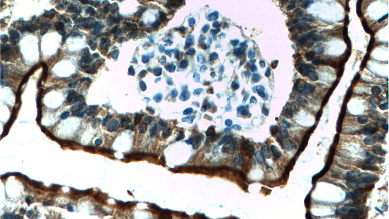 Immunohistochemistry of paraffin-embedded human small intestine tissue slide using Catalog No:116752(VIL1 Antibody) at dilution of 1:2000 (under 40x lens).