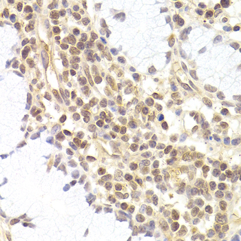 Immunohistochemistry - PHC1 Polyclonal Antibody 