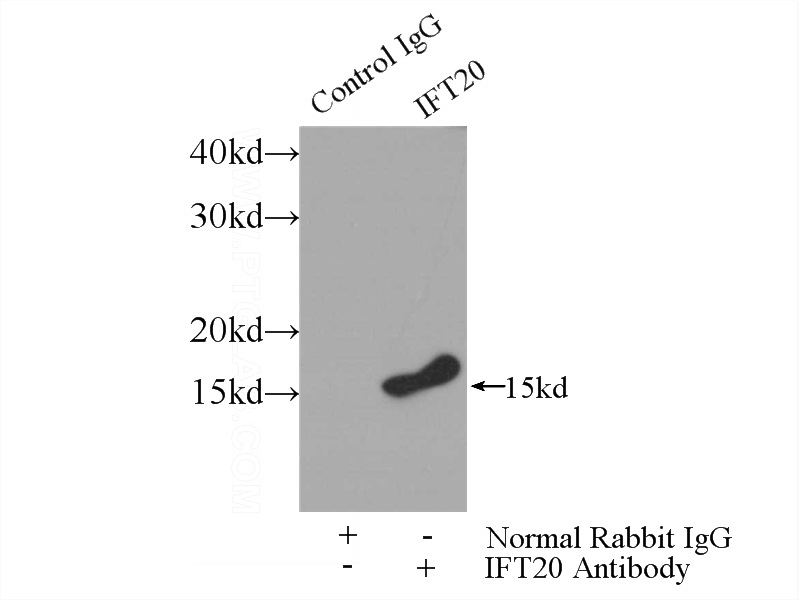 IP Result of anti-IFT20 (IP:Catalog No:111665, 3ug; Detection:Catalog No:111665 1:700) with mouse testis tissue lysate 4000ug.
