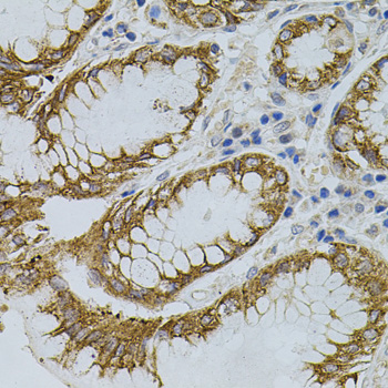 Immunohistochemistry - SIGMAR1 Polyclonal Antibody 