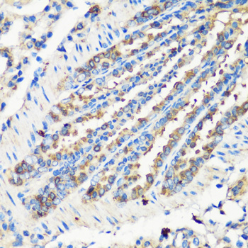 Immunohistochemistry - ELP3 Polyclonal Antibody 