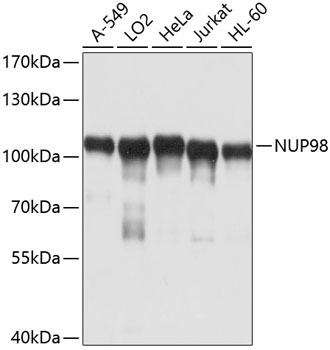 Western blot - NUP98 Polyclonal Antibody 