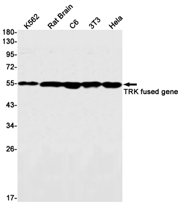 Western blot detection of TRK fused gene in K562,Rat Brain,C6,3T3,Hela cell lysates using TRK fused gene Rabbit mAb(1:1000 diluted).Predicted band size:44kDa.Observed band size:55kDa.