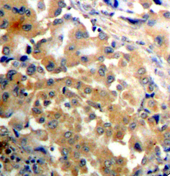 Immunohistochemistry - Phospho-PRKCZ-T410 pAb 