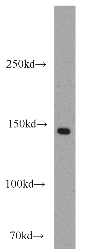 mouse pancreas tissue were subjected to SDS PAGE followed by western blot with Catalog No:109378(COL3A1 antibody) at dilution of 1:1000