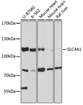 Western blot - SLC4A1 Polyclonal Antibody 