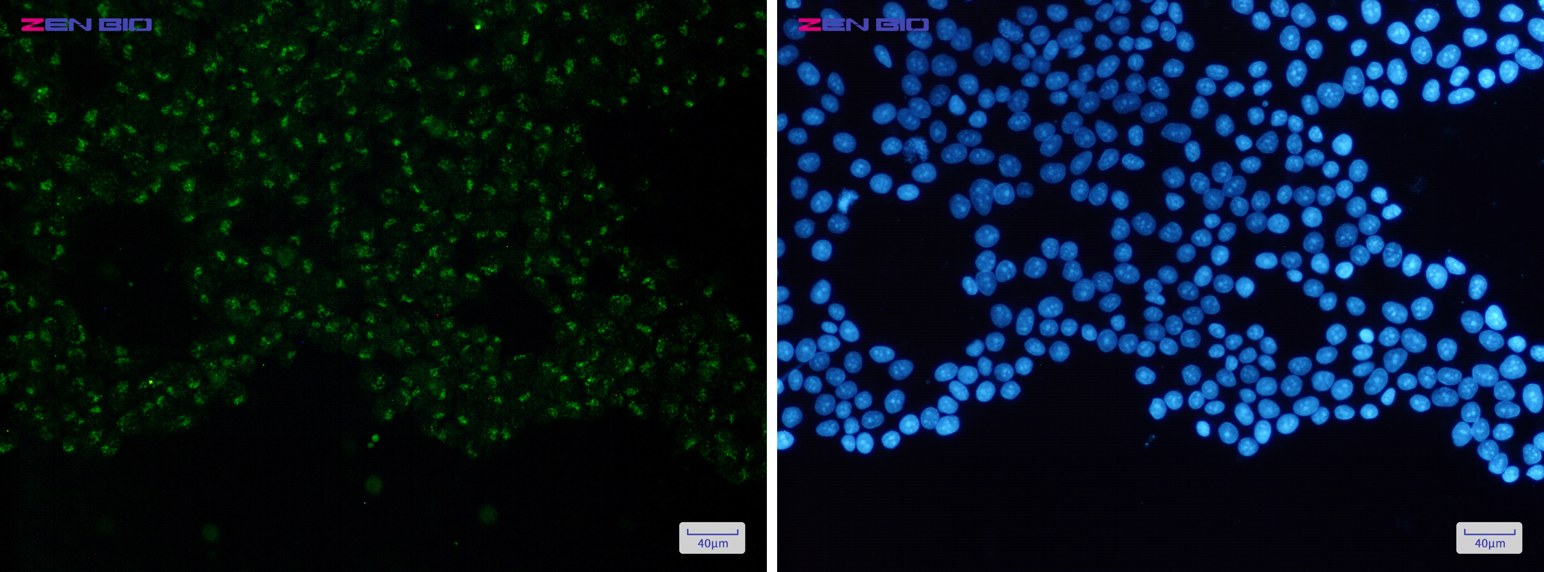 Immunocytochemistry of N-WASP(green) in Hela cells using N-WASP Rabbit pAb at dilution 1/50, and DAPI(blue)