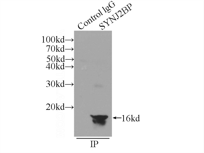 IP Result of anti-ARIP2; SYNJ2BP (IP:Catalog No:115785, 3ug; Detection:Catalog No:115785 1:500) with mouse lung tissue lysate 4000ug.