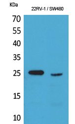 Fig1:; Western Blot analysis of 22RV-1, SW480 cells using SSX Polyclonal Antibody.. Secondary antibody（catalog#：HA1001) was diluted at 1:20000