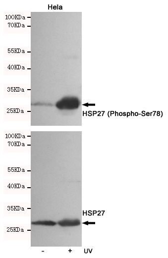 Western blot analysis of extracts from Hela cells, untreated or treated with UV, using HSP27 (Phospho-Ser78) Rabbit pAb (167122,1:500 diluted,upper) or Hsp27 Mouse mAb (200778,lower).