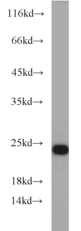 SH-SY5Y cells were subjected to SDS PAGE followed by western blot with Catalog No:114458(RAB7A antibody) at dilution of 1:800