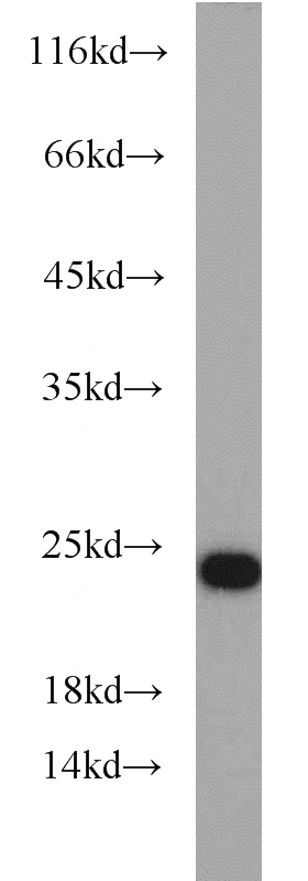 SH-SY5Y cells were subjected to SDS PAGE followed by western blot with Catalog No:114458(RAB7A antibody) at dilution of 1:800