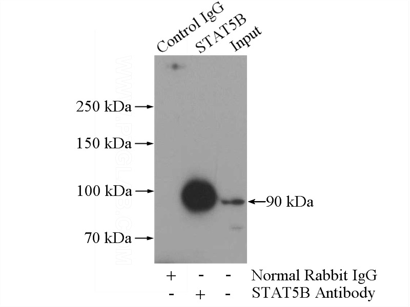 IP Result of anti-STAT5B (IP:Catalog No:115694, 4ug; Detection:Catalog No:115694 1:500) with HeLa cells lysate 1200ug.