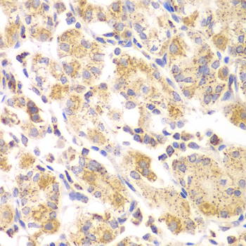Immunohistochemistry - EYA3 Polyclonal Antibody 
