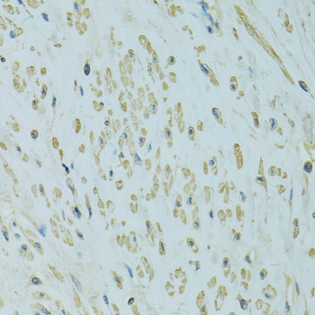 Immunohistochemistry - UGT1A6 Polyclonal Antibody 