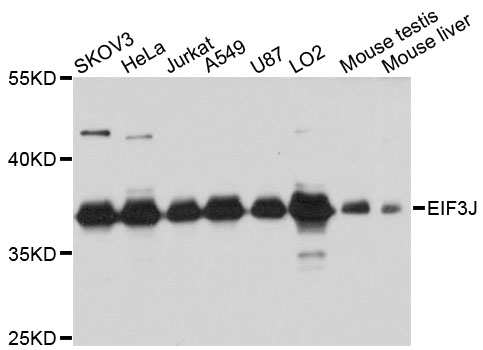 Western blot - EIF3J Polyclonal Antibody 