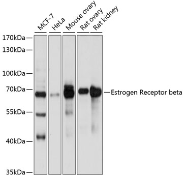 Western blot - Estrogen Receptor beta Polyclonal Antibody 