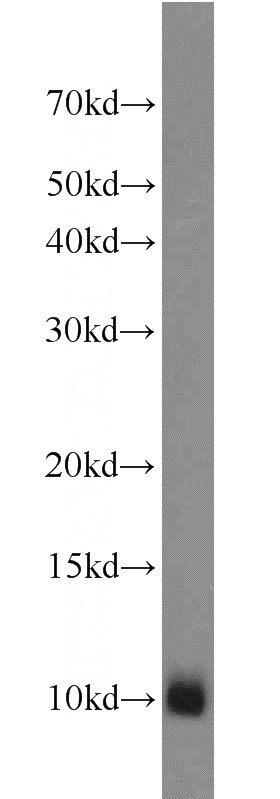 mouse kidney tissue were subjected to SDS PAGE followed by western blot with Catalog No:112758(MPV17L antibody) at dilution of 1:1000