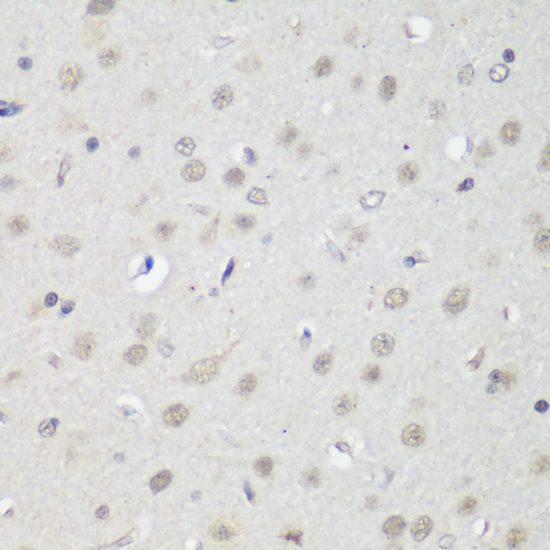Immunohistochemistry - CTCF Polyclonal Antibody 