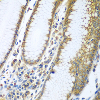 Immunohistochemistry - FUT6 Polyclonal Antibody 
