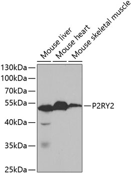 Western blot - P2RY2 Polyclonal Antibody 