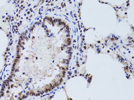 Immunohistochemistry - SIRT7 Polyclonal Antibody 