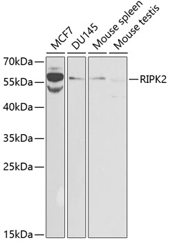 Western blot - RIPK2 Polyclonal Antibody 