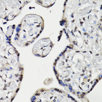 Immunohistochemistry - NAV2 Polyclonal Antibody 