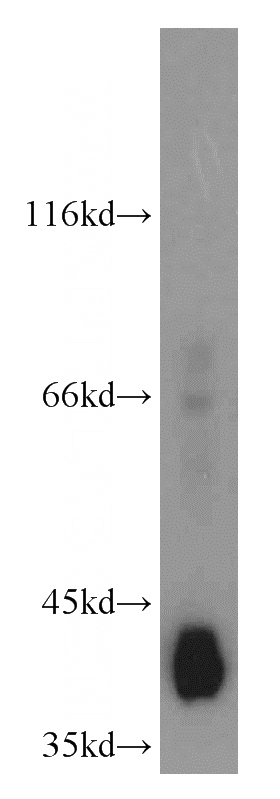 mouse liver tissue were subjected to SDS PAGE followed by western blot with Catalog No:111173(GSNOR,ADH5 antibody) at dilution of 1:800