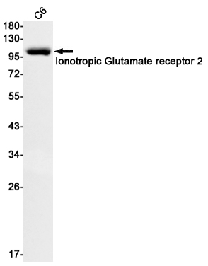 Western blot detection of Ionotropic Glutamate receptor 2 in C6 cell lysates using Ionotropic Glutamate receptor 2 Rabbit mAb(1:1000 diluted).Predicted band size:99kDa.Observed band size:99kDa.
