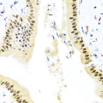 Immunohistochemistry - ZBTB17 Polyclonal Antibody 