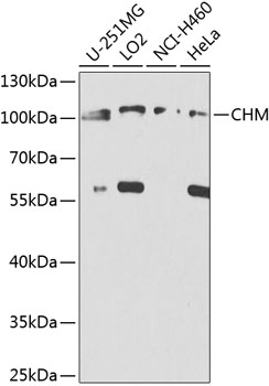 Western blot - CHM Polyclonal Antibody 
