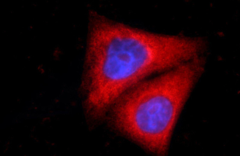 Immunofluorescent analysis of HepG2 cells using Catalog No:115381(SMC4 Antibody) at dilution of 1:50 and Rhodamine-Goat anti-Rabbit IgG
