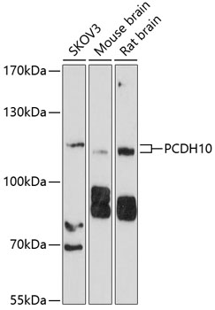 Western blot - PCDH10 Polyclonal Antibody 