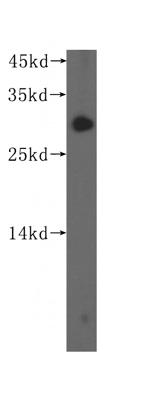 COLO 320 cells were subjected to SDS PAGE followed by western blot with Catalog No:115747(SURF2 antibody) at dilution of 1:300