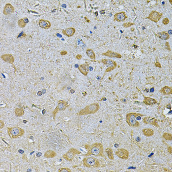 Immunohistochemistry - DAAM2 Polyclonal Antibody 