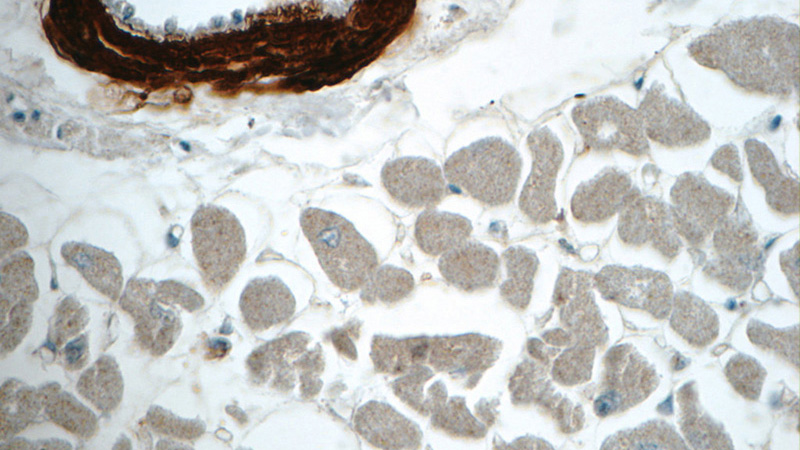 Immunohistochemistry of paraffin-embedded human heart tissue slide using Catalog No:116333(TAGLN Antibody) at dilution of 1:50 (under 40x lens)