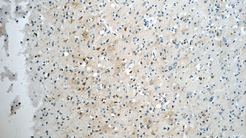 Immunohistochemistry of paraffin-embedded human brain tissue slide using Catalog No:109208(CHAT Antibody) at dilution of 1:50 (under 10x lens)